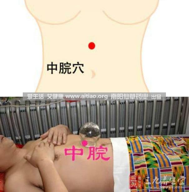 中脘穴位于腹部正中線(xiàn)，臍上4寸的位置上。每天艾灸10-15分鐘，能有效緩解胃部不適的癥狀，同時(shí)有助于祛濕。