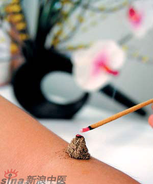 節氣灸” 冬至，你灸了嗎？
